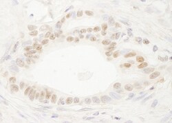 DEK Antibody, Novus Biologicals 0.1mL; Unlabeled:Antibodies, Polyclonal